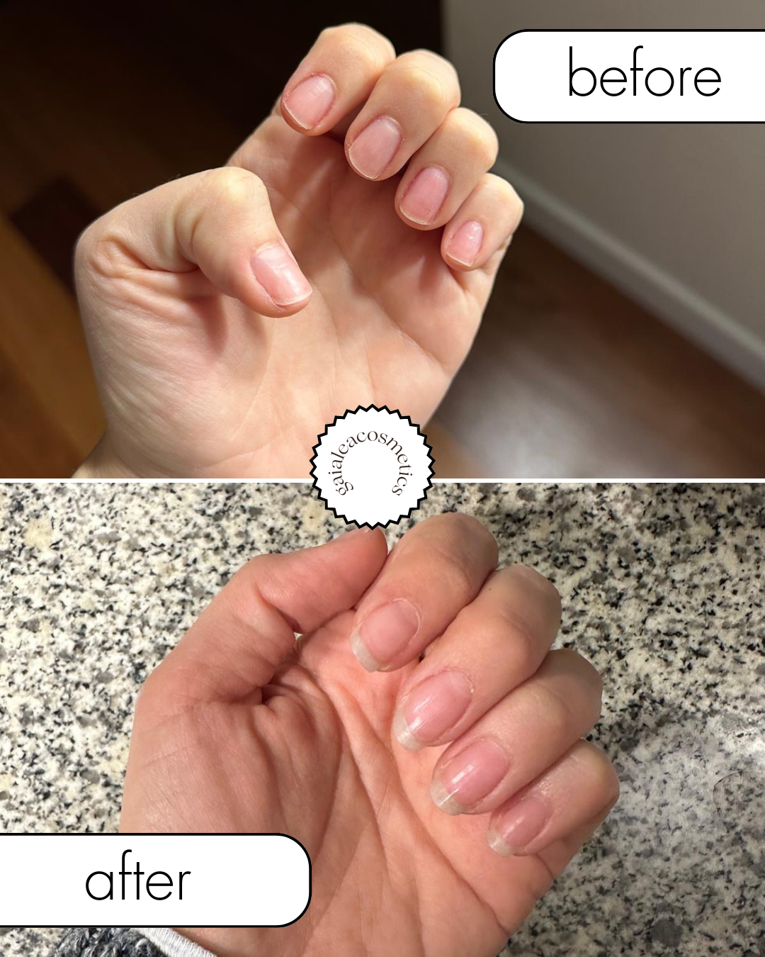 Nail Care Serum – Fast Growth, Anti-Breakage, Repairing, Strengthening & 100% Vegan