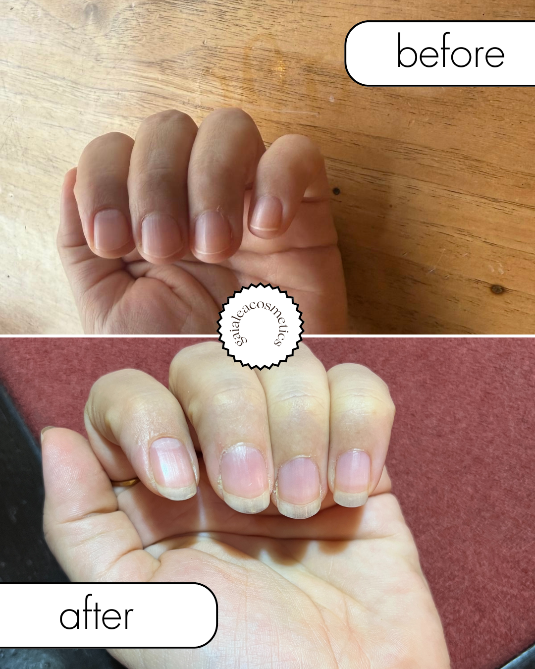 Nail Care Serum – Fast Growth, Anti-Breakage, Repairing, Strengthening & 100% Vegan